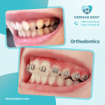 Orthodontics - Derman Dent - Dental Clinic