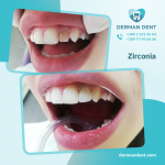 Zirconia - Derman Dent - Dental Clinic
